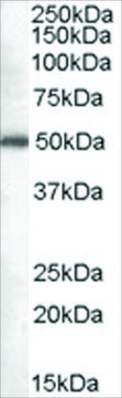 Anti-Dead-box protein 6 antibody produced