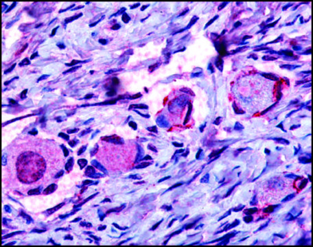Anti-NR4A1 (AB1) antibody produced in