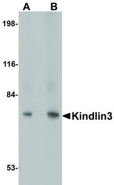 Anti-KINDLIN3 antibody produced in rabbit