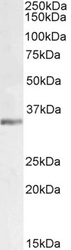 Anti-LDHC (AA 221-233) antibody produced