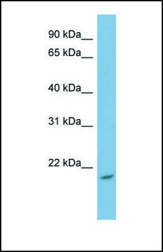 Anti-NME4 antibody produced in rabbit