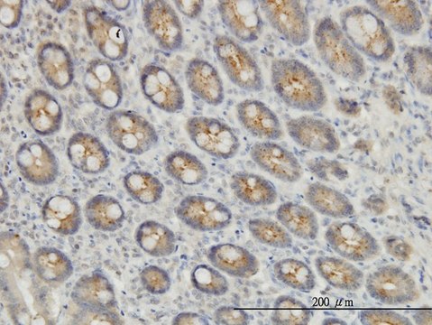 Monoclonal Anti-EXOC7 antibody produced in