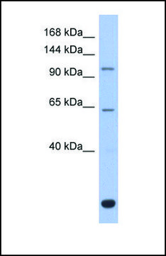 Anti-BACH2 antibody produced in rabbit