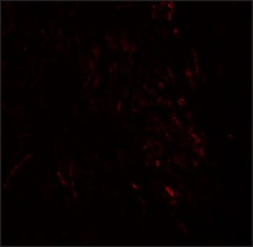 Anti-ZMYM3 antibody produced in rabbit