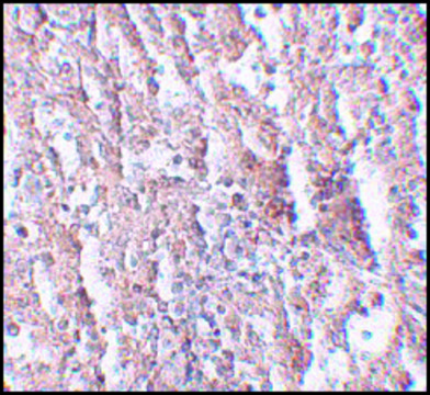 Anti-ZIP5 antibody produced in rabbit