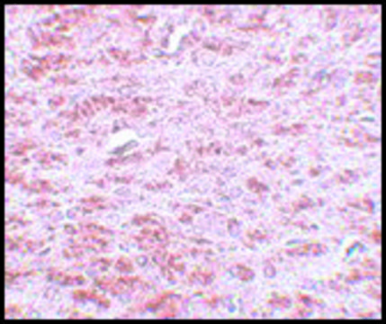Anti-CDX2 antibody produced in rabbit