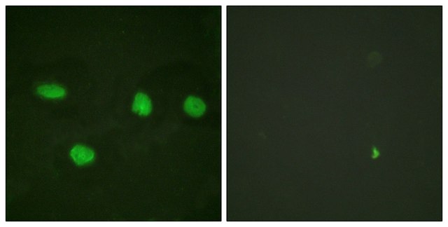 Anti-53BP1 antibody produced in rabbit