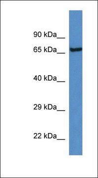 Anti-KLKB1 antibody produced in rabbit