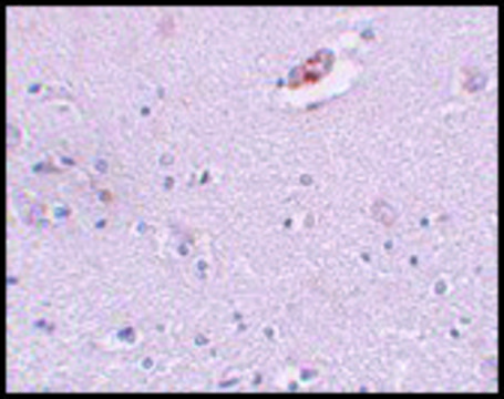 Anti-ZNF536 antibody produced in rabbit