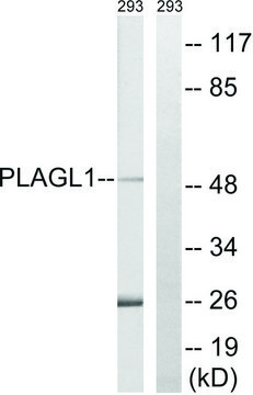 Anti-PLAGL1 antibody produced in rabbit