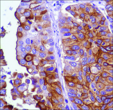 Anti-Uroplakin III antibody, Rabbit monoclonal