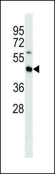 ANTI-MOUSE STRADB (C-TERM) antibody produced