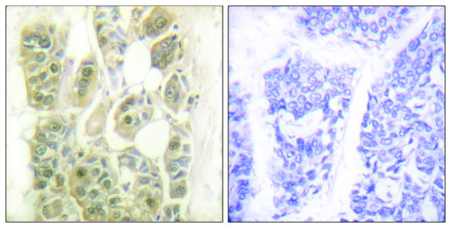 Anti-SSB antibody produced in rabbit