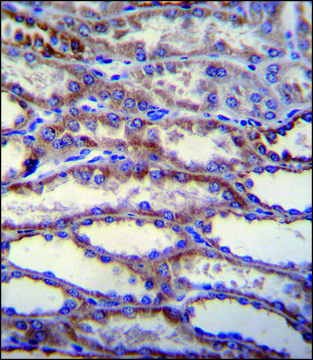 ANTI-SHISA3 (C-TERM) antibody produced in