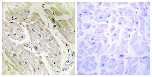 Anti-PRKAG2 antibody produced in rabbit