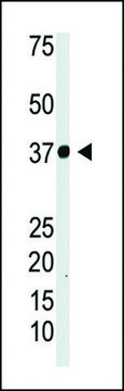 ANTI-IKB ALPHA (IKBA) antibody produced