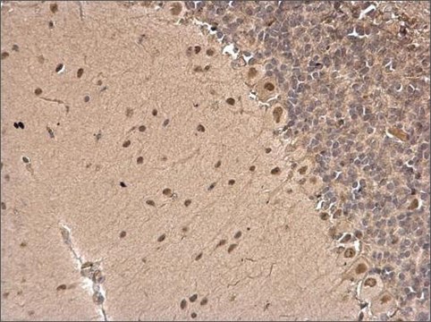 Anti-ERCC6 antibody produced in rabbit