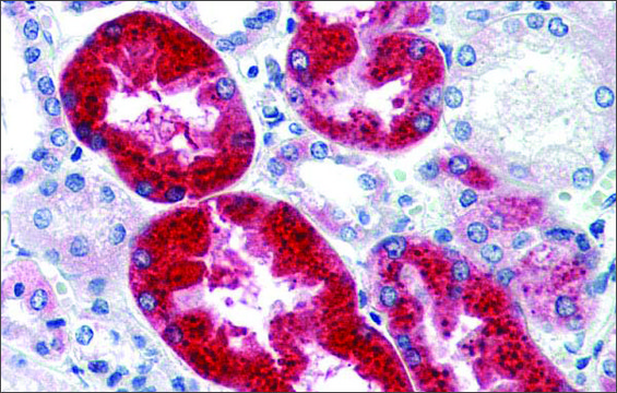 Anti-EYA1 antibody produced in rabbit