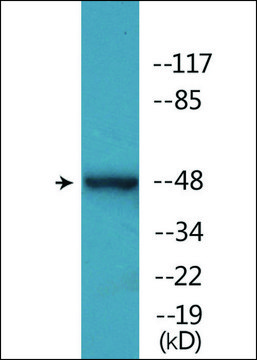 Anti-phospho-YAP (pSer¹²?) antibody produced in