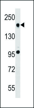 ANTI-TET2 (N-TERM) antibody produced in