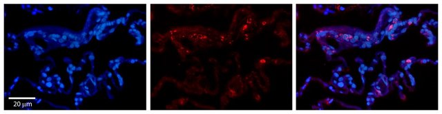 Anti-BCKDHA, (N-terminal) antibody produced in