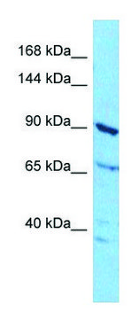 Anti-ABCF1 (N-terminal) antibody produced in
