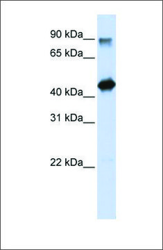 Anti-HMG20A antibody produced in rabbit