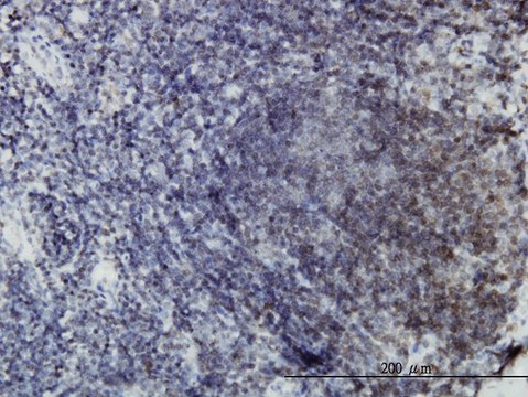 ANTI-EPHB3 antibody produced in mouse