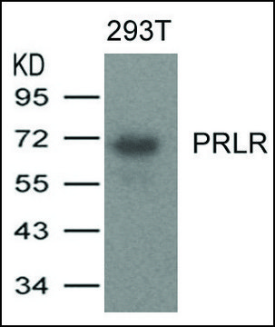 Anti-PRLR antibody produced in rabbit