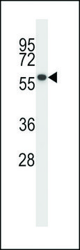 ANTI-PPM1D (CENTER) antibody produced in