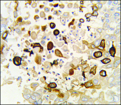 Anti-CYP4X1 (N-term) antibody produced in