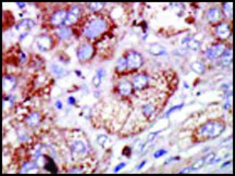 Anti-PFKFB4 (center) antibody produced in