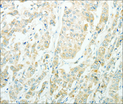 Anti-AGBL1 antibody produced in rabbit