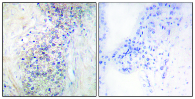 Anti-LRAT antibody produced in rabbit