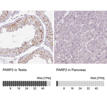 Anti-PARP2 antibody produced in rabbit