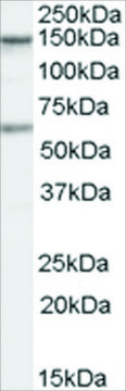 Anti-CARD11 antibody produced in goat