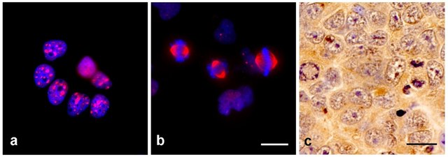 Monoclonal Anti-TPX2 antibody produced in