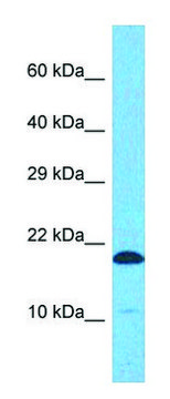 Anti-EIF5A (C-terminal) antibody produced in