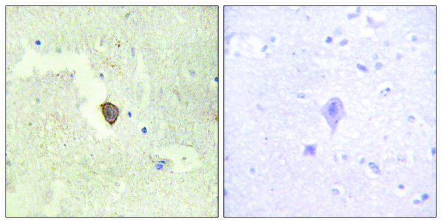 Anti-ADCY7 antibody produced in rabbit