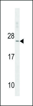 ANTI-TNNC2 (C-TERM) antibody produced in