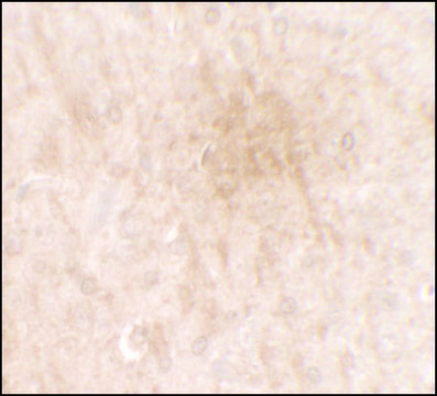 Anti-FGFR3 antibody produced in rabbit