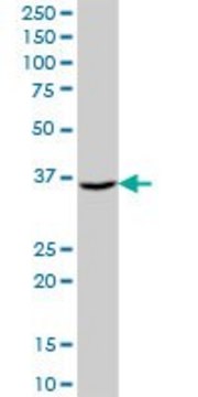 Anti-AKR7A3 antibody produced in mouse