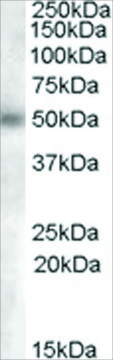Anti-GCNT3 (AA 273-284) antibody produced