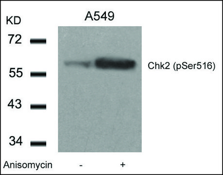 Anti-phospho-CHEK2 (pSer?¹?) antibody produced in