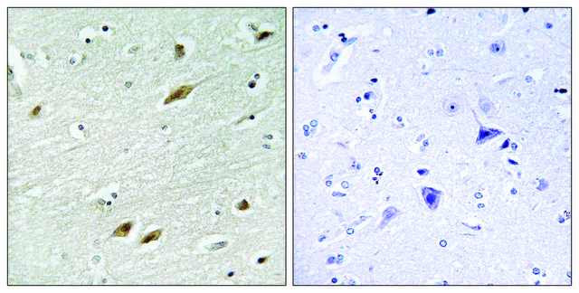 Anti-FKHR antibody produced in rabbit