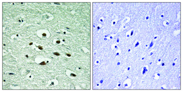 Anti-phospho-Chk1 (pSer²??) antibody produced in
