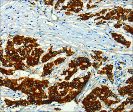 Anti-ADCY3 antibody produced in rabbit