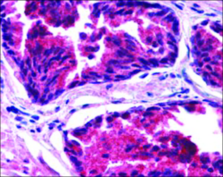 Anti-SNX26/TCGAP, N-Terminal antibody produced in
