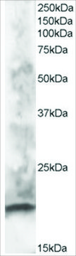 Anti-CABP1 antibody produced in goat