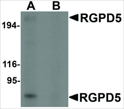 Anti-RGPD5 (ab2) antibody produced in